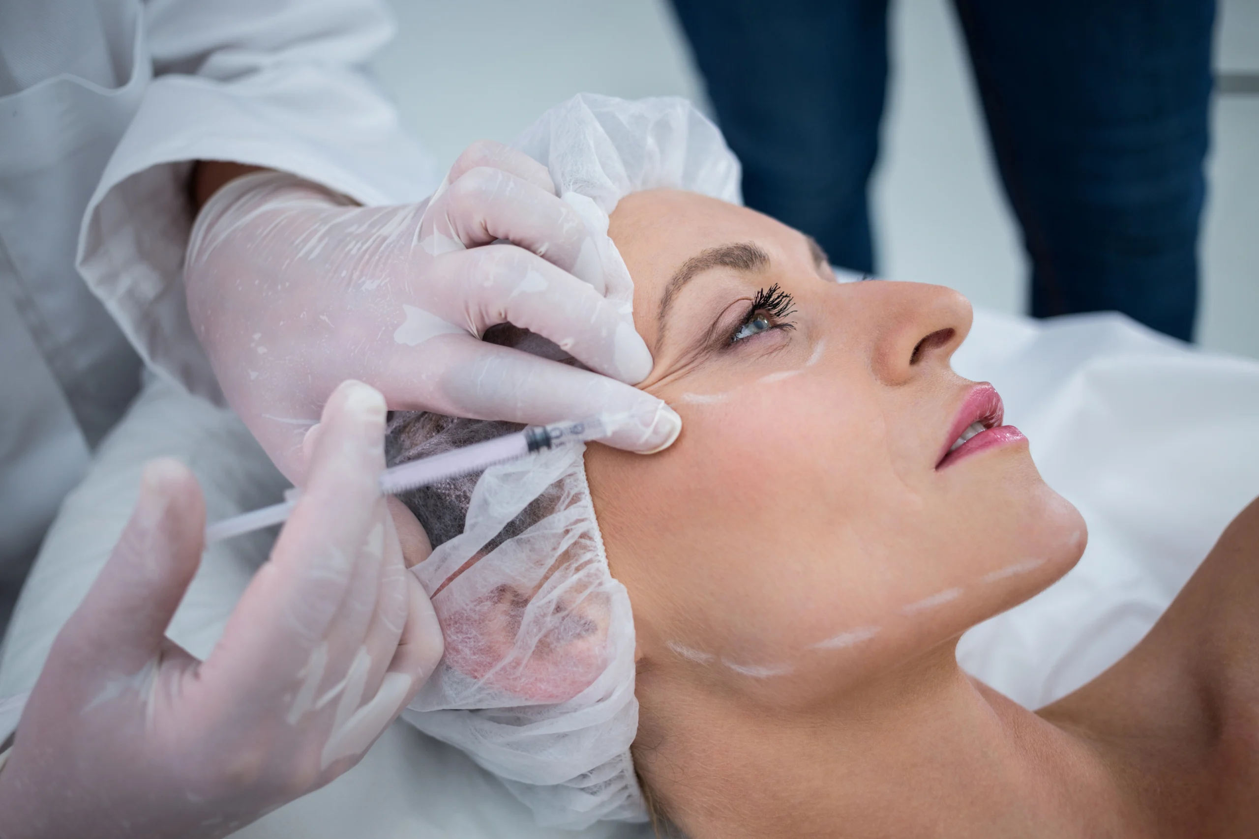 botox treatment 1